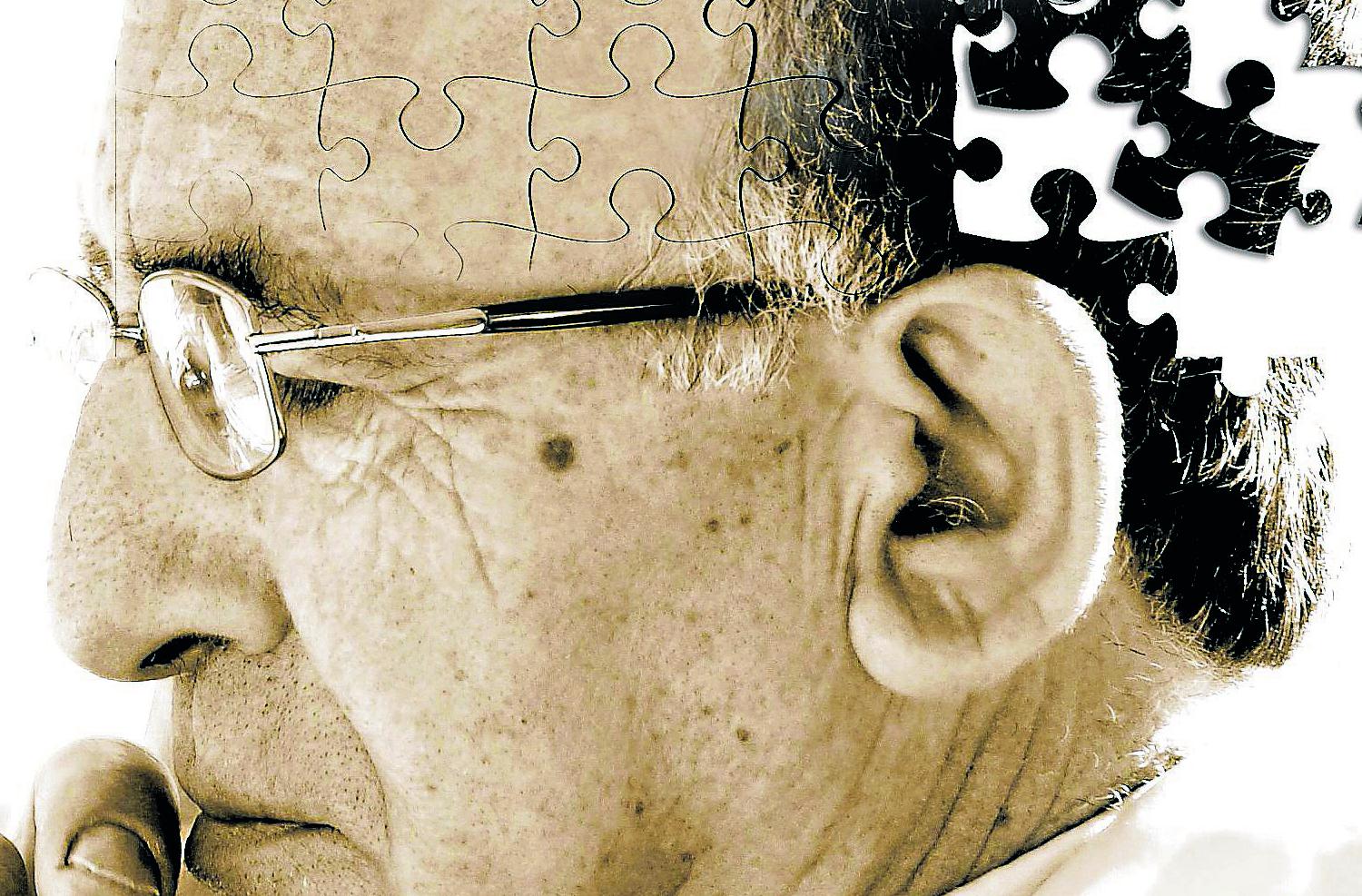 Alzheimer Testi Alzheimer Testi