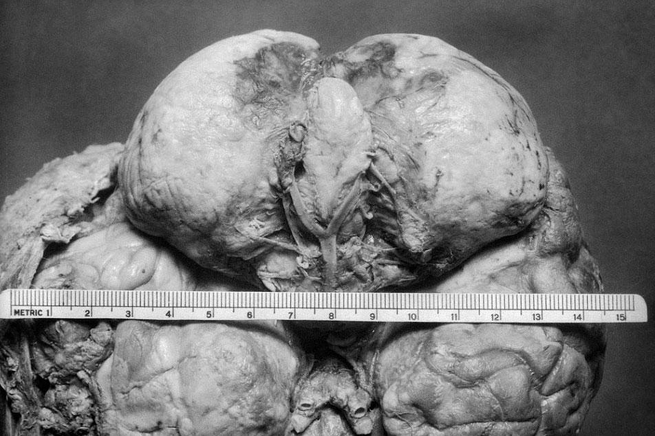 Bir beyin cerrahının albümü