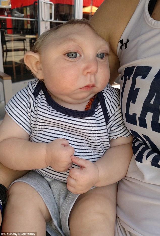 Kimsenin inanmadığı mucize bebek