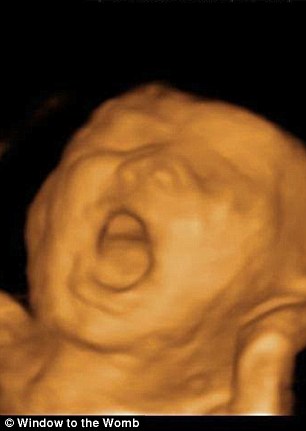 bebek-ultrason 2