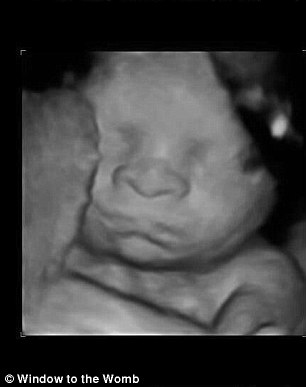 bebek-ultrason 5