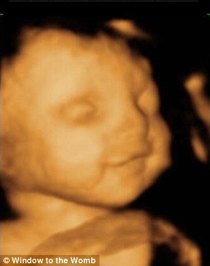 bebek-ultrason 6