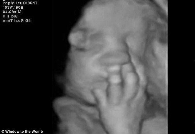 bebek-ultrason 8
