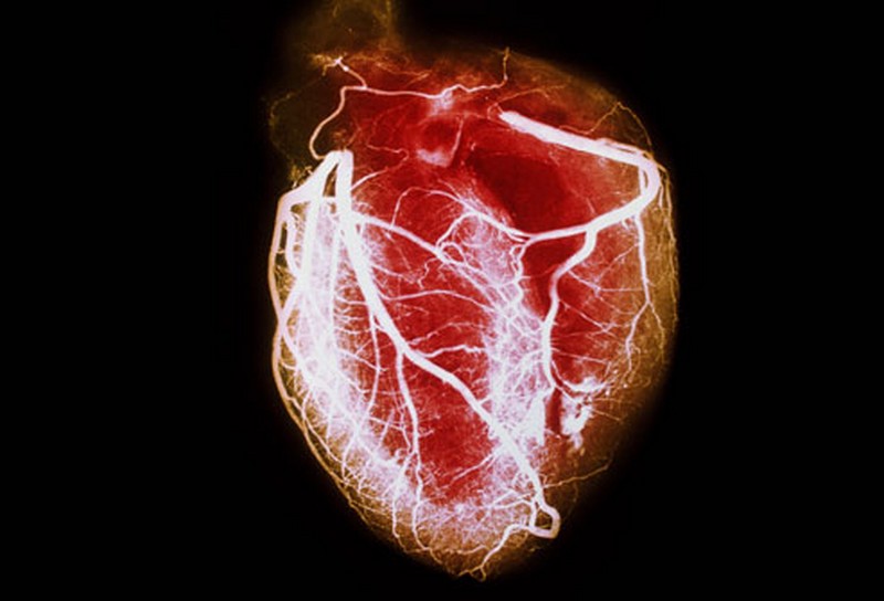 4. Kalp hastalıkları