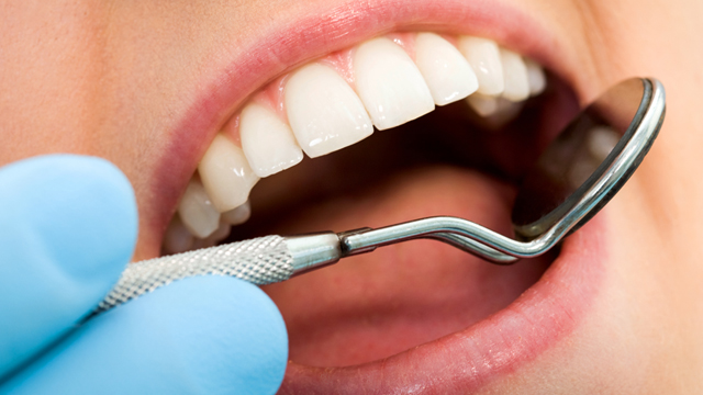 Diş Sağlığı İle İlgili Doğru Bilinen 10 Yanlış